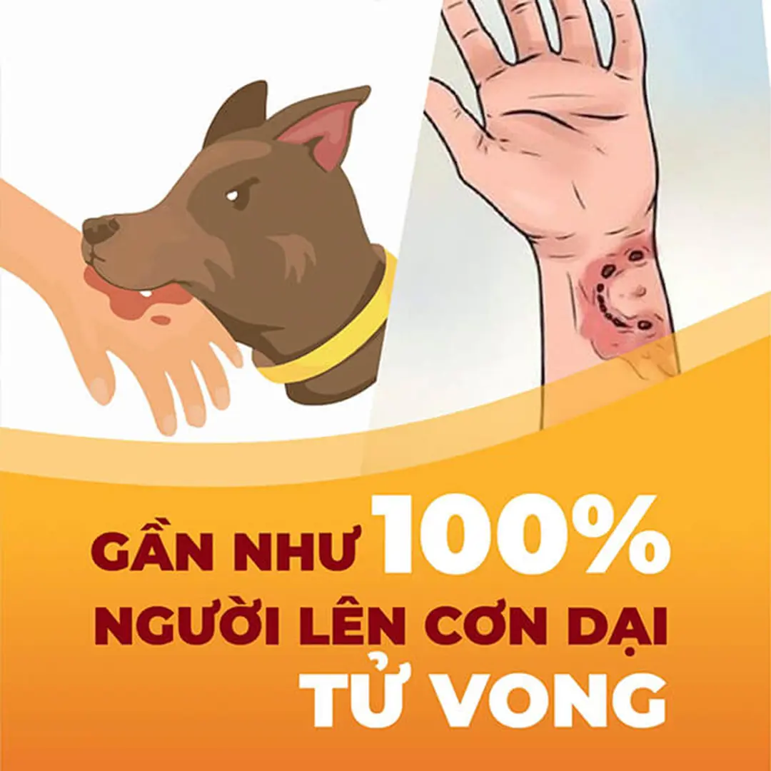 Nhiều trẻ bị chó cắn đa vết thương toàn thân 