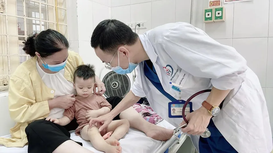 Cả nước ghi nhận hơn 10.000 ca mắc tay chân miệng