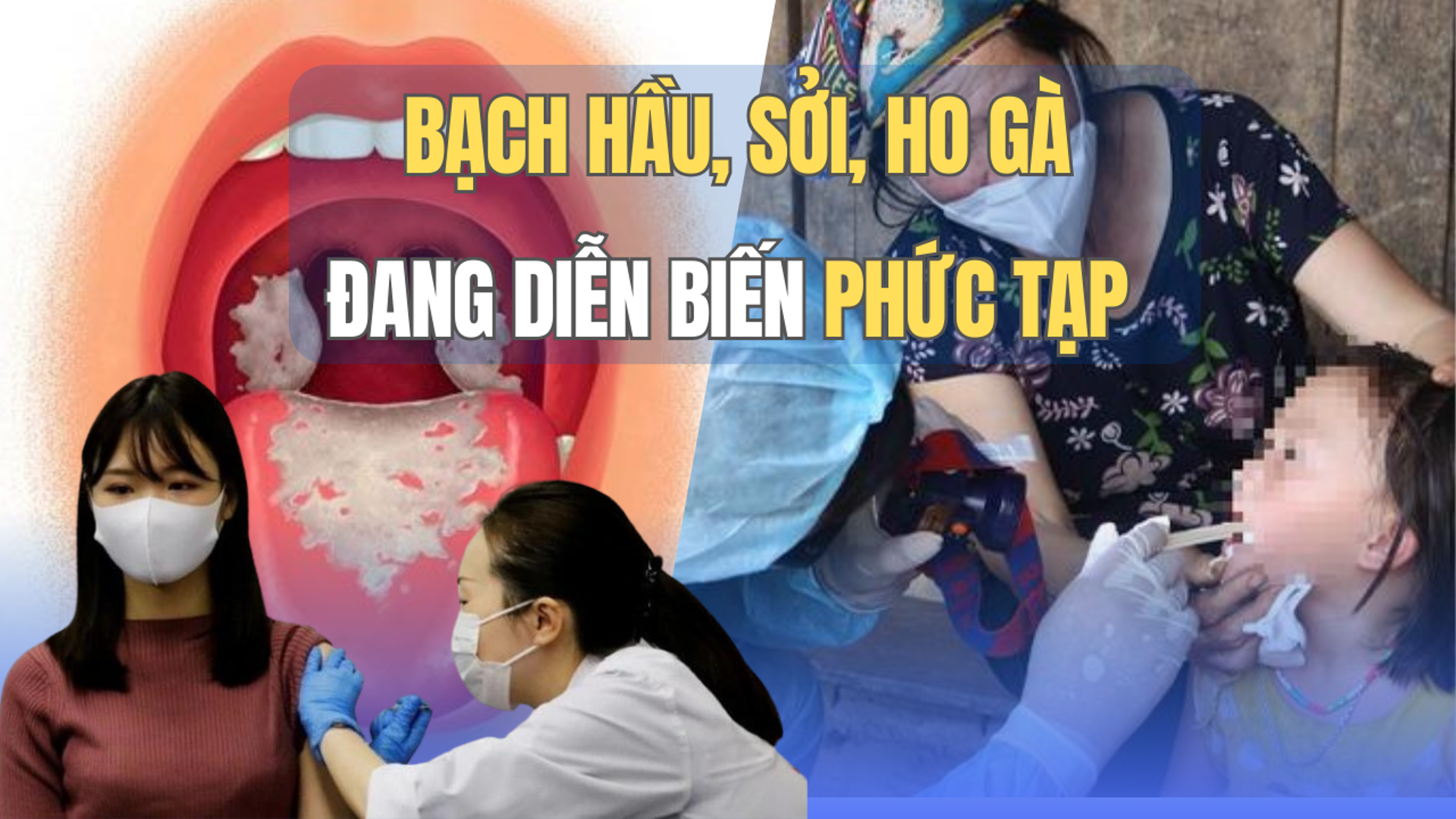 Bệnh bạch hầu, sởi, ho gà đang diễn biến phức tạp