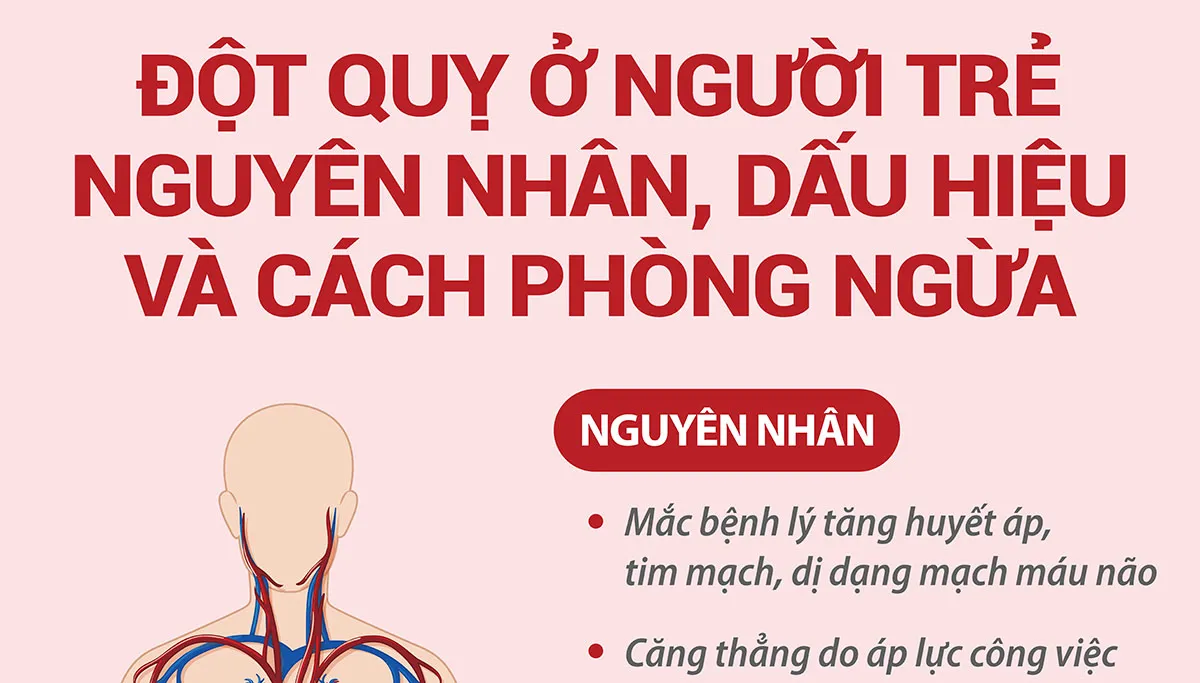 Nguyên nhân, dấu hiệu, cách phòng ngừa đột quỵ ở người trẻ