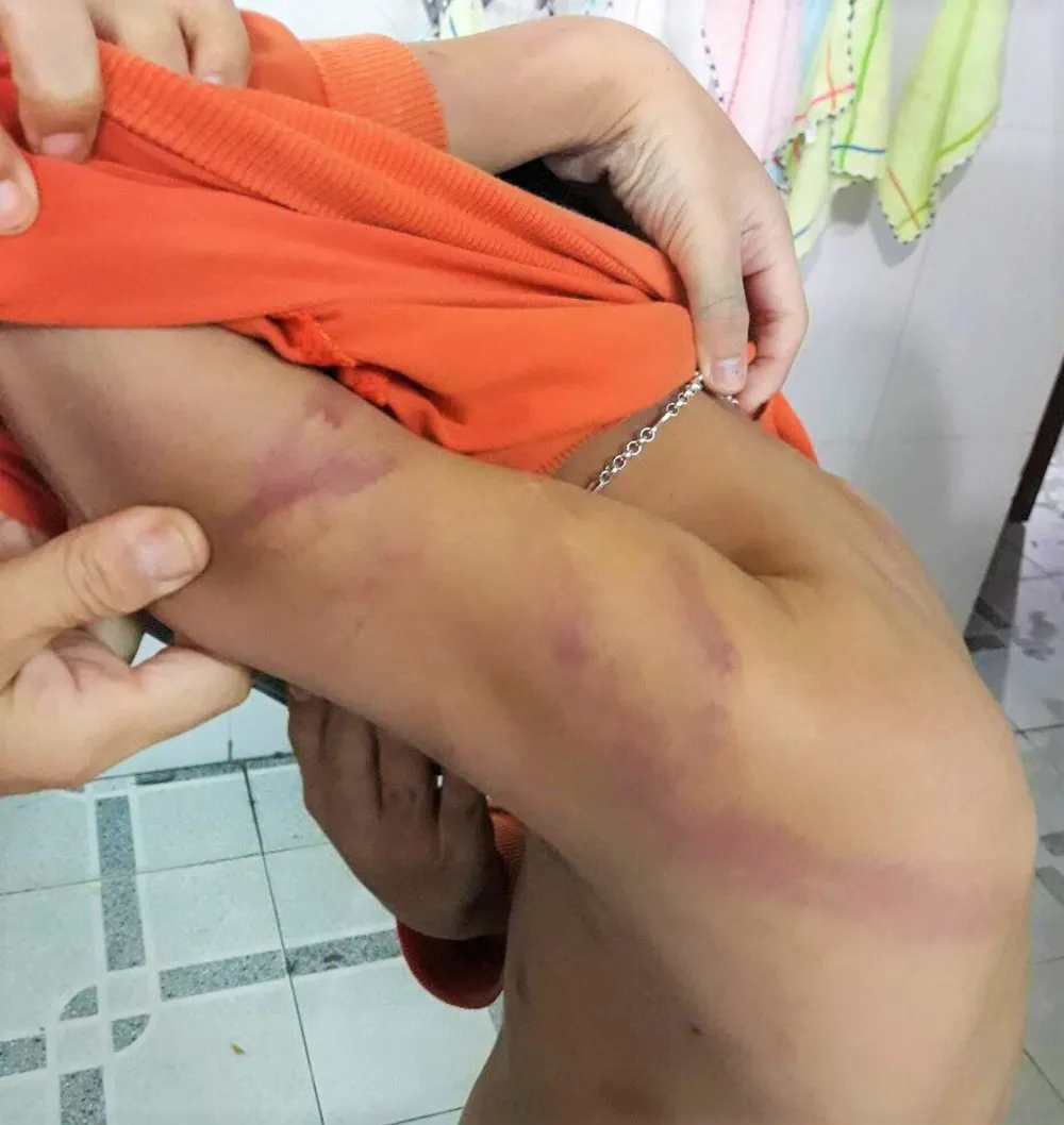 Đề xuất phạt hành chính người cha có dấu hiệu bạo hành con trai ruột