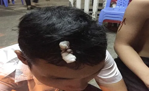 Đà Nẵng: Nhóm côn đồ hành hung, phá hoại tài sản của học sinh