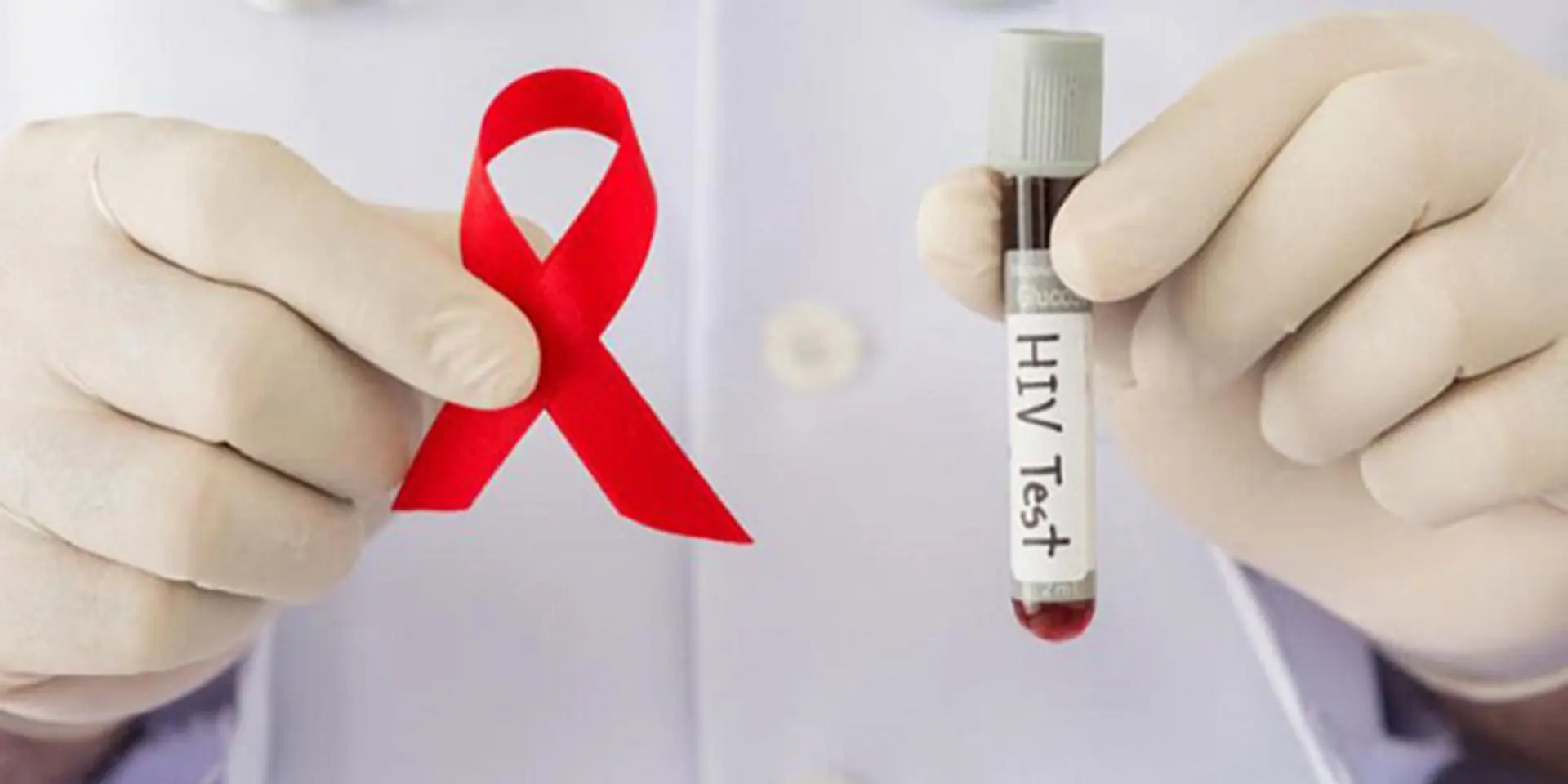 Hà Nội: 79,6% người nhiễm HIV còn sống biết được tình trạng của mình