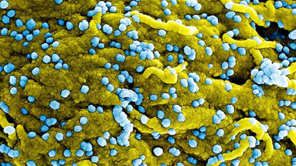 Làm gì để phòng ngừa virus Marburg?