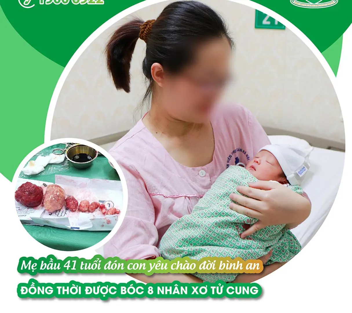 Hà Nội: Bóc thành công 8 nhân xơ tử cung cho sản phụ 41 tuổi