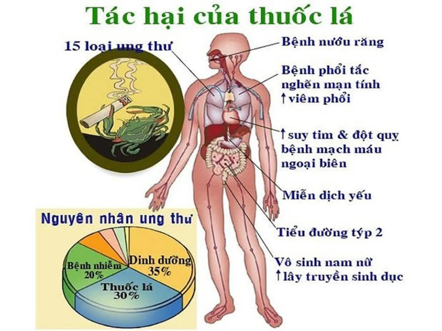 Nhiều ca bệnh nặng, nguy kịch do tác hại của khói thuốc