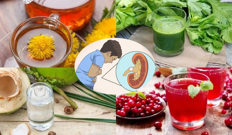 Những loại nước uống người bị sỏi thận uống vào giúp tiêu sỏi, giảm đau. Ảnh minh họa