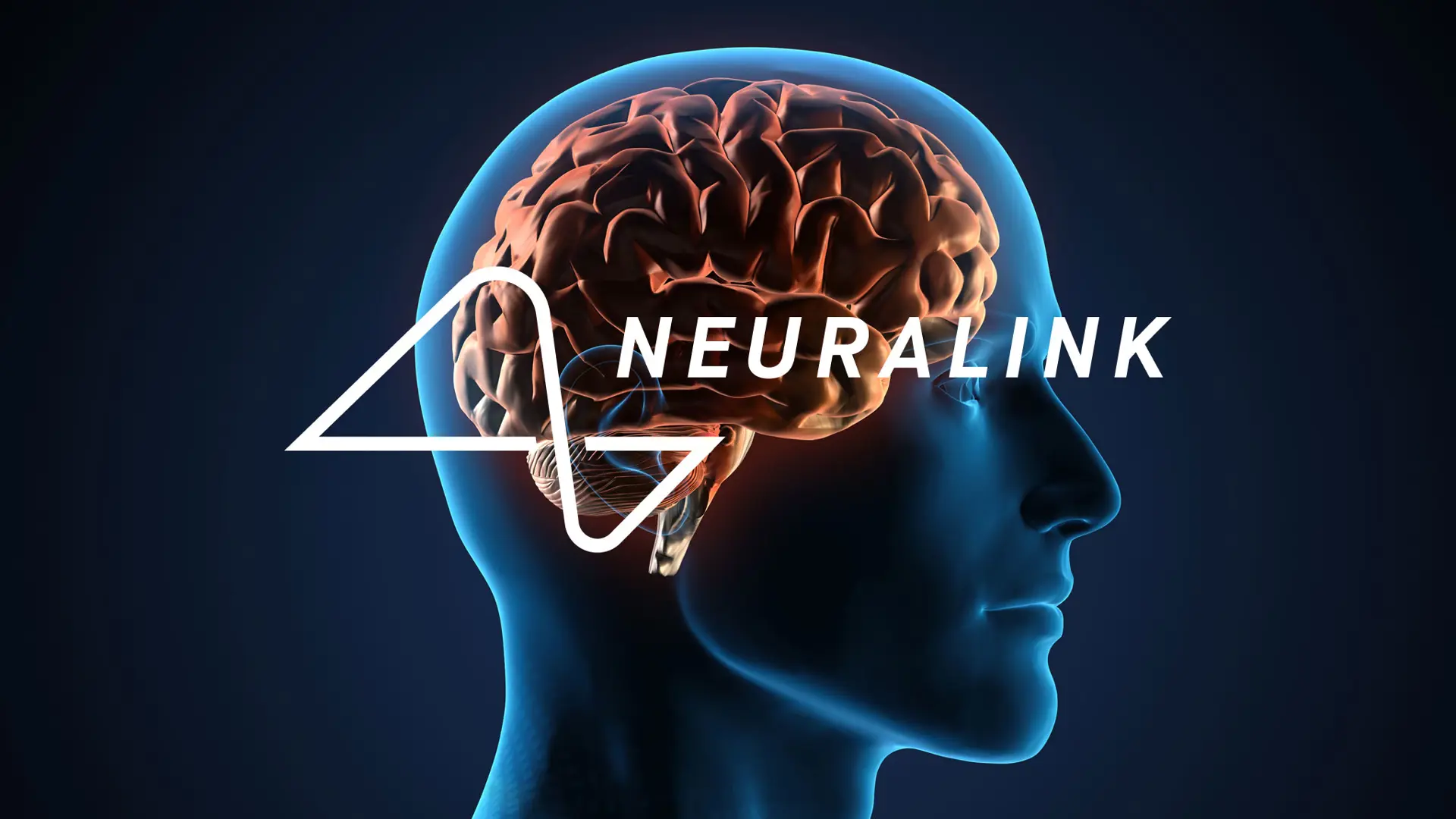 Neuralink được phép thử nghiệm cấy chip vào não người lần 2