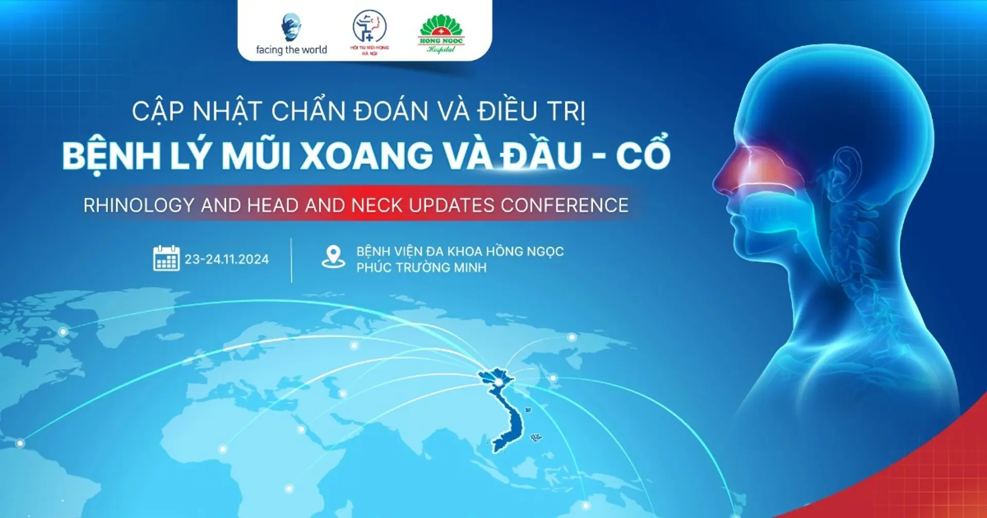 Cập nhật mới về chẩn đoán và điều trị bệnh lý mũi xoang, đầu - cổ