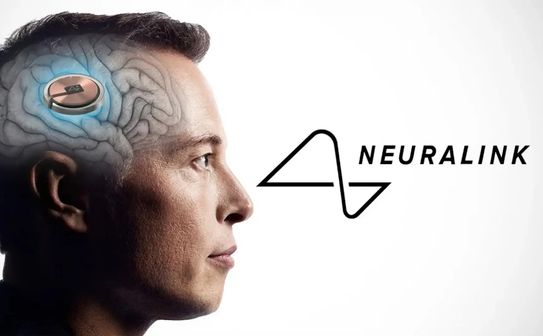 Canada cho phép Neuralink thử nghiệm cấy chip vào não người