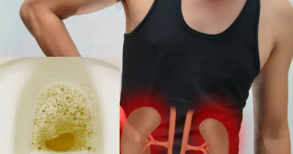 4 dấu hiệu cảnh báo suy thận bạn cần nắm rõ
