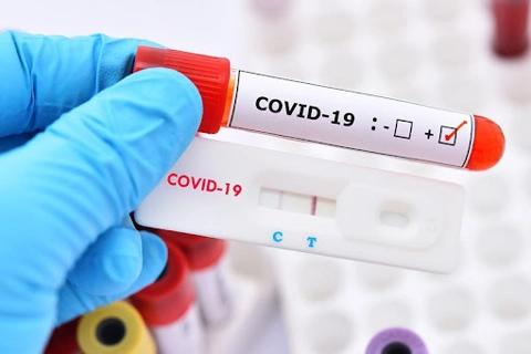 Thái Bình tăng cường phòng chống dịch Covid-19