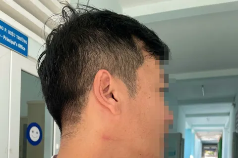 Bộ GD&ĐT chỉ đạo xử lý vụ thầy giáo hành hung đồng nghiệp