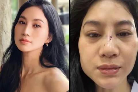 Diễn viên Phi Ngọc Ánh tiết lộ tình trạng sau khi bị chồng cũ đánh