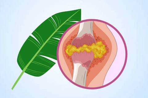 Lá chuối giúp giảm axit uric