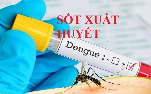 Hình ảnh 1