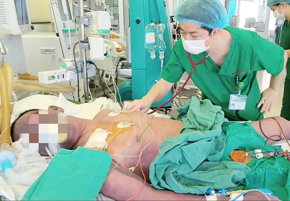 Ăn lòng lợn, một người đàn ông nguy kịch do mắc liên cầu khuẩn