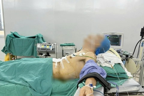 Phẫu thuật ung thư dạ dày cho bệnh nhân gù vẹo cột sống nặng

