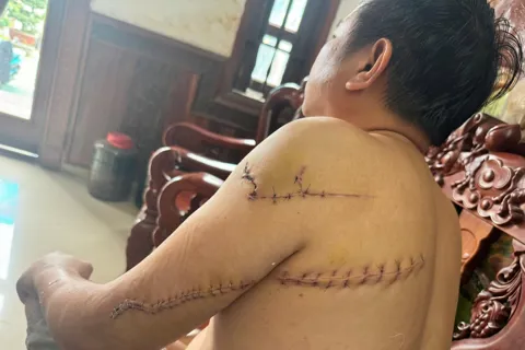 Vụ truy sát ở Đồng Nai: Cơ quan công an đang điều tra, làm rõ các đối tượng gây án
