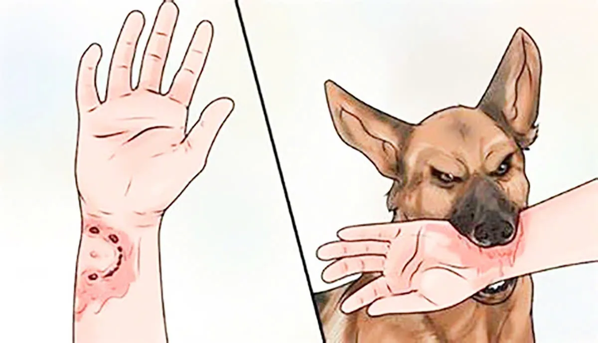 Đắk Lắk: ghi nhận trường hợp bệnh nhân tử vong nghi do bệnh dại