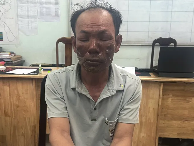Hình ảnh 1
